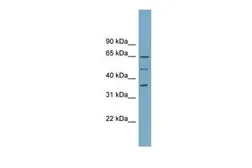 Anti-WDR33 antibody, N-term used in Western Blot (WB). GTX46693