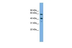 Anti-ATP8B2 antibody, N-term used in Western Blot (WB). GTX46695