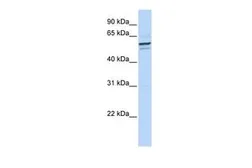 Anti-GPNMB antibody, N-term used in Western Blot (WB). GTX46706