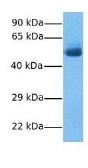 Anti-GPNMB antibody, N-term used in Western Blot (WB). GTX46707