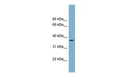 Anti-OR2W5 antibody, Internal used in Western Blot (WB). GTX46709