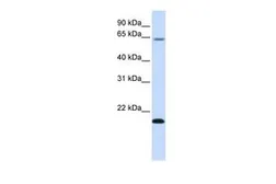 Anti-FAM19A3 antibody, Internal used in Western Blot (WB). GTX46711