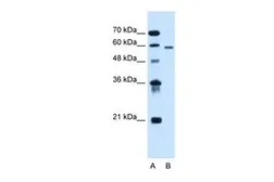 Anti-ALG11 antibody, C-term used in Western Blot (WB). GTX46717