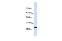 Anti-C1ORF95 antibody, Internal used in Western Blot (WB). GTX46723