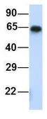 Anti-MCTP1 antibody, Internal used in Western Blot (WB). GTX46725