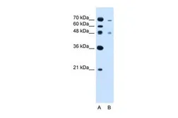 Anti-ZFYVE27 antibody, C-term used in Western Blot (WB). GTX46727