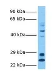 Anti-LYCAT antibody, Internal used in Western Blot (WB). GTX46729