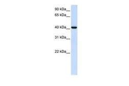Anti-DGAT2L4 antibody, C-term used in Western Blot (WB). GTX46730