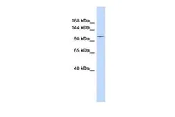 Anti-PMCA3 ATPase antibody, N-term used in Western Blot (WB). GTX46737