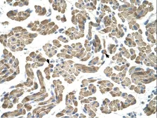 Anti-NEU1 antibody, Internal used in IHC (Paraffin sections) (IHC-P). GTX46743