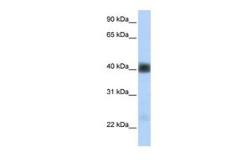 Anti-beta Sarcoglycan antibody, Internal used in Western Blot (WB). GTX46747