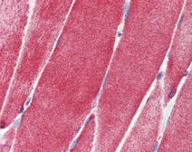 Anti-SLC36A2 antibody, N-term used in IHC (Paraffin sections) (IHC-P). GTX46757