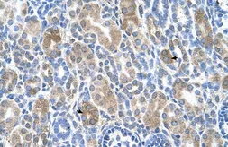 Anti-SLC36A3 antibody, N-term used in IHC (Paraffin sections) (IHC-P). GTX46758