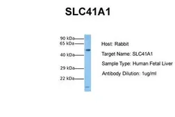 Anti-SLC41A1 antibody, N-term used in Western Blot (WB). GTX46760