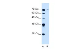 Anti-SLCO6A1 antibody, C-term used in Western Blot (WB). GTX46762