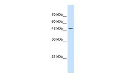 Anti-SLC43A2 antibody, N-term used in Western Blot (WB). GTX46770