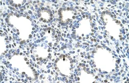 Anti-SLC15A4 antibody, N-term used in IHC (Paraffin sections) (IHC-P). GTX46773