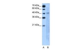 Anti-SLC25A46 antibody, N-term used in Western Blot (WB). GTX46779
