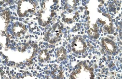 Anti-SLC37A3 antibody, Internal used in IHC (Paraffin sections) (IHC-P). GTX46786
