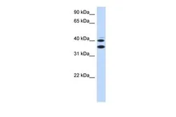 Anti-SLC25A32 antibody, Internal used in Western Blot (WB). GTX46788
