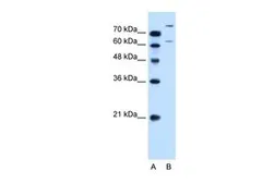 Anti-SLC26A1 antibody, C-term used in Western Blot (WB). GTX46796