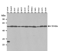 Anti-SLC30A1 antibody, Internal used in Western Blot (WB). GTX46800