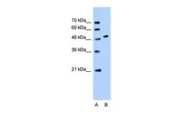 Anti-SLC30A1 antibody, Internal used in Western Blot (WB). GTX46800