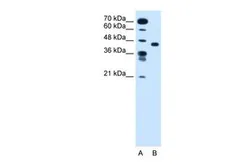 Anti-SLC35C1 antibody, N-term used in Western Blot (WB). GTX46808