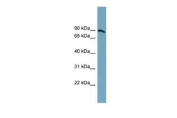 Anti-SLC6A14 antibody, Internal used in Western Blot (WB). GTX46822