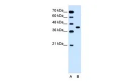 Anti-SLC35B1 antibody, C-term used in Western Blot (WB). GTX46823