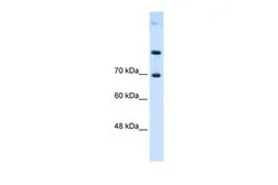 Anti-SLC7A4 antibody, Internal used in Western Blot (WB). GTX46833