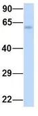 Anti-SLC7A7 antibody, Internal used in Western Blot (WB). GTX46837