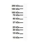 Anti-SLC7A1 antibody, N-term used in Western Blot (WB). GTX46841