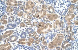 Anti-SLC38A1 antibody, Internal used in IHC (Paraffin sections) (IHC-P). GTX46849