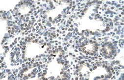 Anti-SLC10A5 antibody, C-term used in IHC (Paraffin sections) (IHC-P). GTX46856