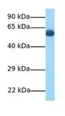 Anti-DMT1 antibody, N-term used in Western Blot (WB). GTX46861