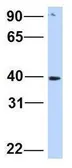 Anti-SNTB1 antibody, N-term used in Western Blot (WB). GTX46866