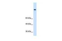 Anti-MTTP antibody, N-term used in Western Blot (WB). GTX46869