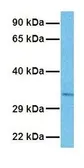 Anti-GLS2 antibody, Internal used in Western Blot (WB). GTX46870