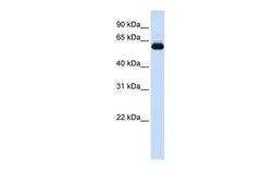 Anti-TRIM60 antibody, N-term used in Western Blot (WB). GTX46885