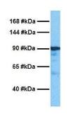 Anti-FBXO11 antibody, Internal used in Western Blot (WB). GTX46904