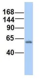 Anti-RC3H2 antibody, Internal used in Western Blot (WB). GTX46912