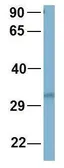Anti-RNF126 antibody, N-term used in Western Blot (WB). GTX46914