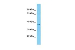 Anti-MARCH5 antibody, N-term used in Western Blot (WB). GTX46916