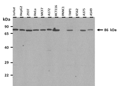 Anti-RNF43 antibody, Internal used in Western Blot (WB). GTX46918