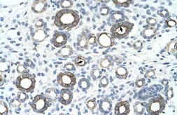 Anti-UBE2J1 antibody, N-term used in IHC (Paraffin sections) (IHC-P). GTX46922