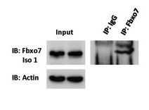 Anti-FBXO7 antibody, Internal used in Immunoprecipitation (IP). GTX46925