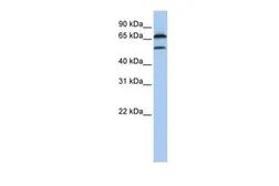 Anti-FBXO7 antibody, Internal used in Western Blot (WB). GTX46925