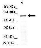 Anti-NEDD4 antibody, Internal used in Western Blot (WB). GTX46935