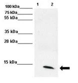 Anti-UBE2L6 antibody, Internal used in Western Blot (WB). GTX46936